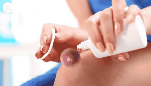 5 cách trị mụn nhọt tại nhà hiệu quả nhanh chóng